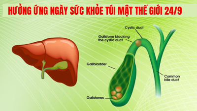 [Giải đáp] Mọi điều bạn cần biết để có một túi mật khỏe mạnh 